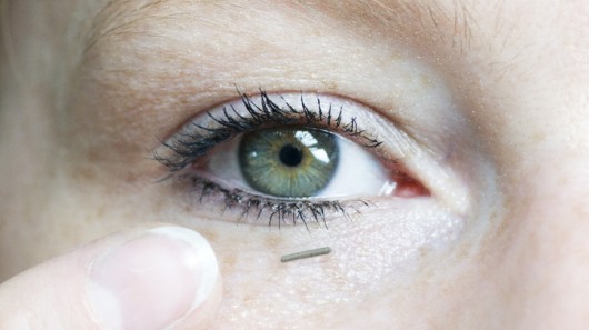 Cảm biến sinh học đo nồng độ đường trong máu không xâm lấn