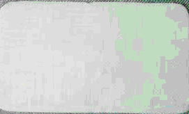 Màng trị bỏng sinh học