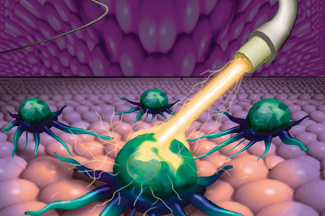 Hồi phục vết thương bằng công nghệ mới