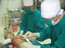 Màng sinh học chữa bỏng chất lượng cao